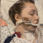 Tumbler Ridge survivor’s condition still critical but improving